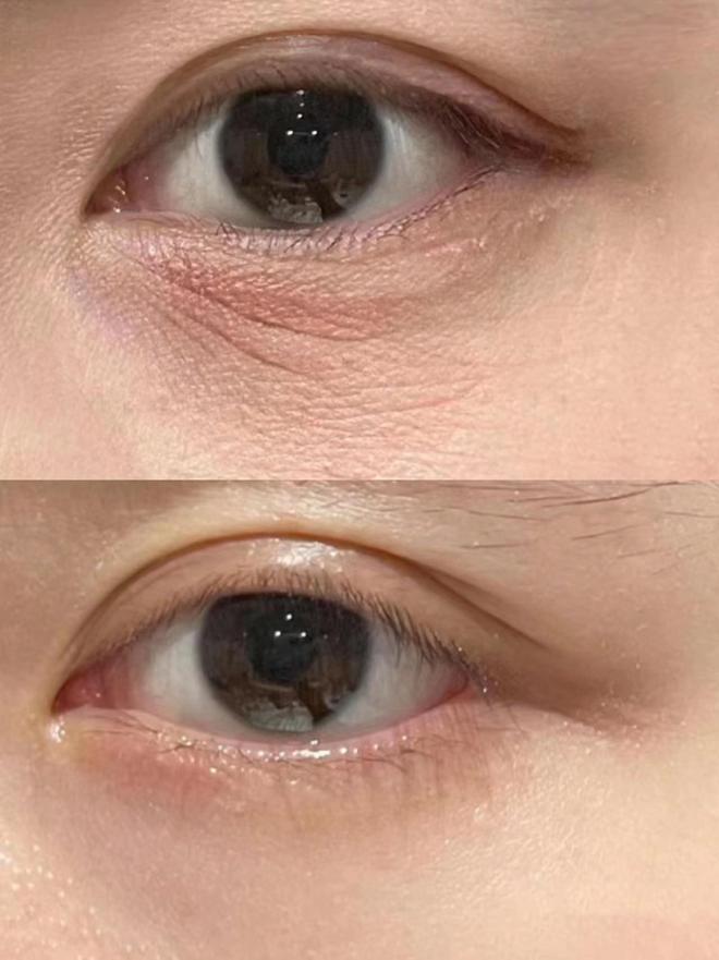 ！主打一个选对不选贵口碑高的眼霜揭秘AG旗舰厅app去眼袋第一名的眼霜(图5)